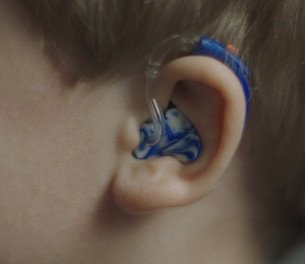 hearing aid on child