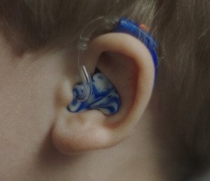 ear with hearing aid